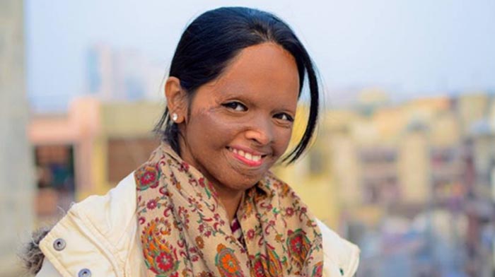 Read How this Indian Acid Attack Survivor is transforming lives of Hundreds of People #Hopeneverdies